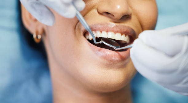 Best Emergency Tooth Extraction in Cross Plains, TX