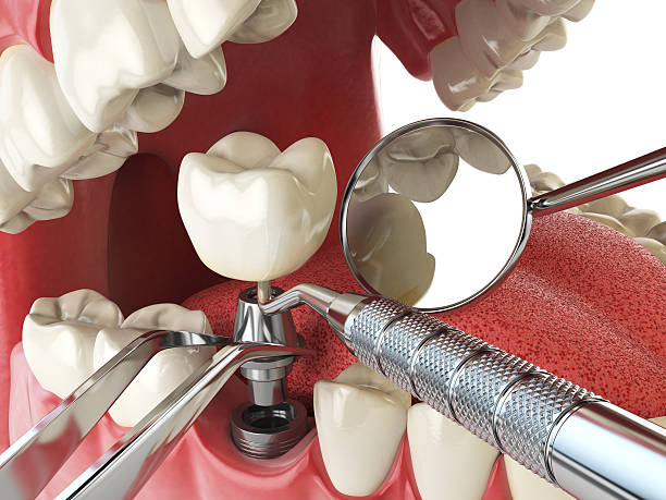 Best Emergency Dental Surgery in Cross Plains, TX
